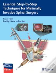 Essential Step-By-Step Techniques For Minimally Invasive Spinal Surgery