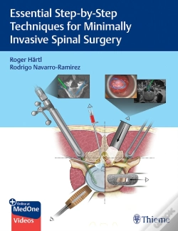 Capa do artigo Essential Step-By-Step Techniques For Minimally Invasive Spinal Surgery