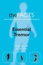 Essential Tremor - Preview