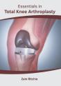 Essentials In Total Knee Arthroplasty - Preview