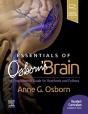 Essentials Of Osborn'S Brain E-Book - Preview