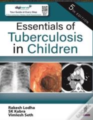 Essentials Of Tuberculosis In Children