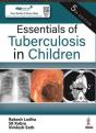 Essentials Of Tuberculosis In Children - Preview