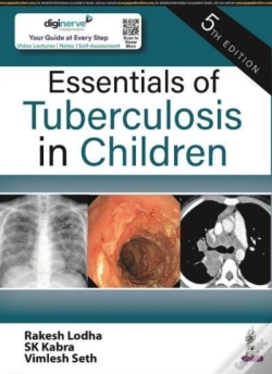 Capa do artigo Essentials Of Tuberculosis In Children