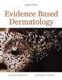 Evidence Based Dermatology - Preview