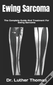 Capa do artigo Ewing Sarcoma