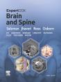 Expertddx: Brain And Spine E-Book - Preview