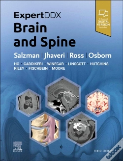 Capa do artigo Expertddx: Brain And Spine