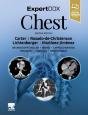 Expertddx: Chest - Preview