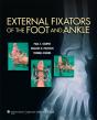 External Fixators Of The Foot And Ankle - Preview