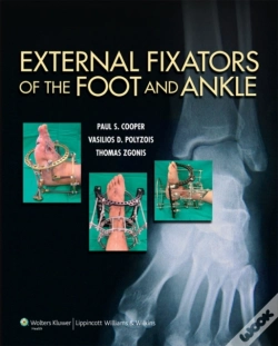 Capa do artigo External Fixators Of The Foot And Ankle