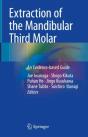 Extraction Of The Mandibular Third Molar - Preview