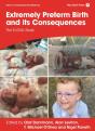 Extremely Preterm Birth And Its Consequences - Preview