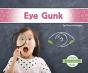 Eye Gunk - Preview