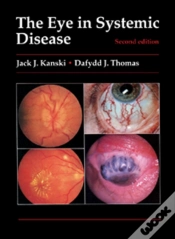 Capa do artigo Eye In Systemic Disease