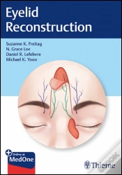 Capa do artigo Eyelid Reconstruction