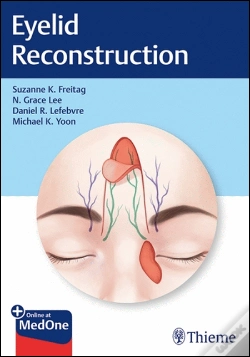 Capa do artigo Eyelid Reconstruction