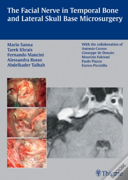 Capa do artigo Facial Nerve In Temporal Bone And Lateral Skull Base Microsurgery