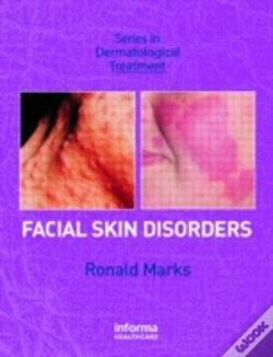 Capa do artigo Facial Skin Disorders