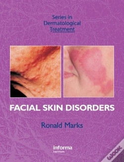 Capa do artigo Facial Skin Disorders
