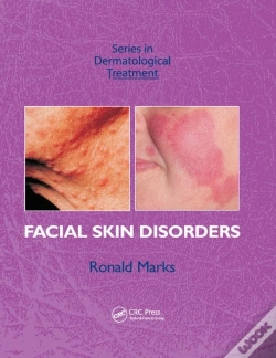 Capa do artigo Facial Skin Disorders