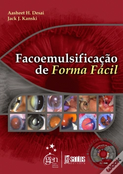 Capa do artigo Facoemulsificação de Forma Fácil