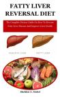 Fatty Liver Reversal Diet - Preview