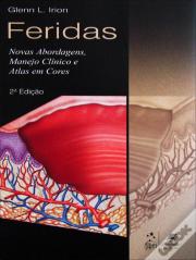 Feridas