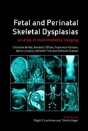 Fetal And Perinatal Skeletal Dysplasias - Preview