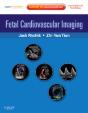 Fetal Cardiovascular Imaging: A Disease Based Approach - Preview