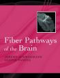 Fiber Pathways Of The Brain - Preview