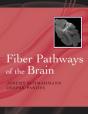 Fiber Pathways Of The Brain - Preview