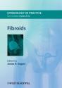 Fibroids - Preview