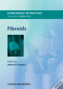 Capa do artigo Fibroids