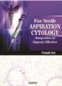 Fine Needle Aspiration Cytology Interpretation And Diagnostic Difficulties - Preview