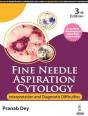 Fine Needle Aspiration Cytology - Preview