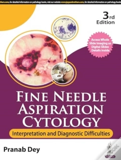Capa do artigo Fine Needle Aspiration Cytology