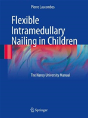 Flexible Intramedullary Nailing In Children - Preview