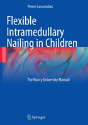 Flexible Intramedullary Nailing In Children - Preview