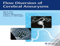 Flow Diversion Of Cerebral Aneurysms