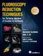 Fluoroscopy Reduction Techniques For Catheter Ablation Of Cardiac Arrhythmias - Preview