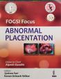 Fogsi Focus Abnormal Placentation - Preview