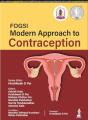 Fogsi: Modern Approach To Contraception - Preview