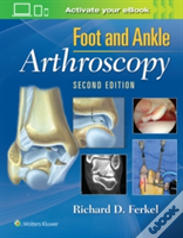 Foot & Ankle Arthroscopy