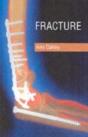 Fracture - Preview