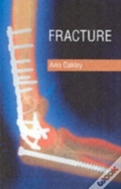 Capa do artigo Fracture