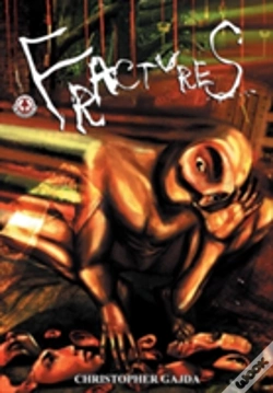 Capa do artigo Fractures