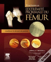 Capa do artigo Fractures De L
