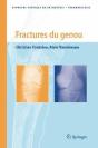 Fractures Du Genou - Preview