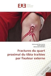 Fractures Du Quart Proximal Du Tibia Traitees Par Fixateur Externe
